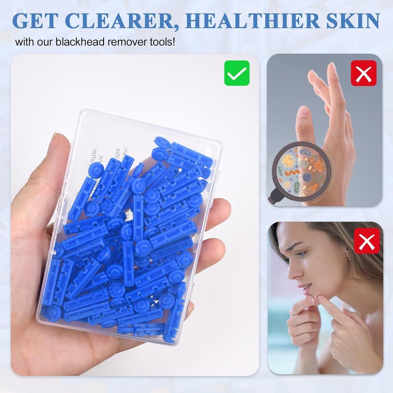 Lishae Acne Needle, 50 Pcs Disposable sterile Needles and 70 Dots Pimple Stickers for Acnes, Whitehead, Comedone Removal (122 Piece Set) - Image 2